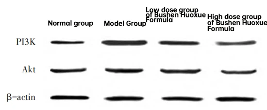 Figure 2 Western Blot electropherograms of PI3K and Akt proteins in renal tissues in each groups of rats Figure 2 Western Blot electropherograms of PI3K and Akt proteins in renal tissues in each groups of rats
